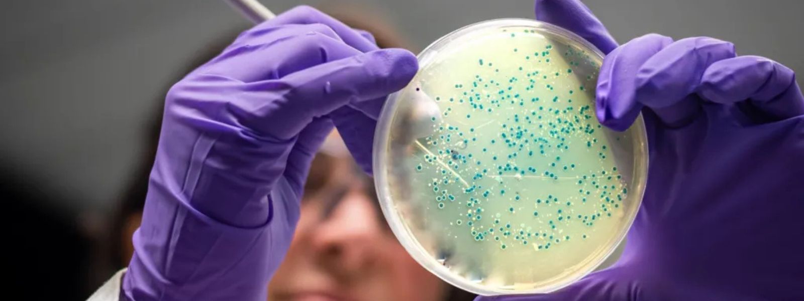 AI Helps MIT Discover Game-Changing Antibiotics